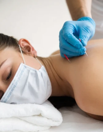 What is Dry Needling?